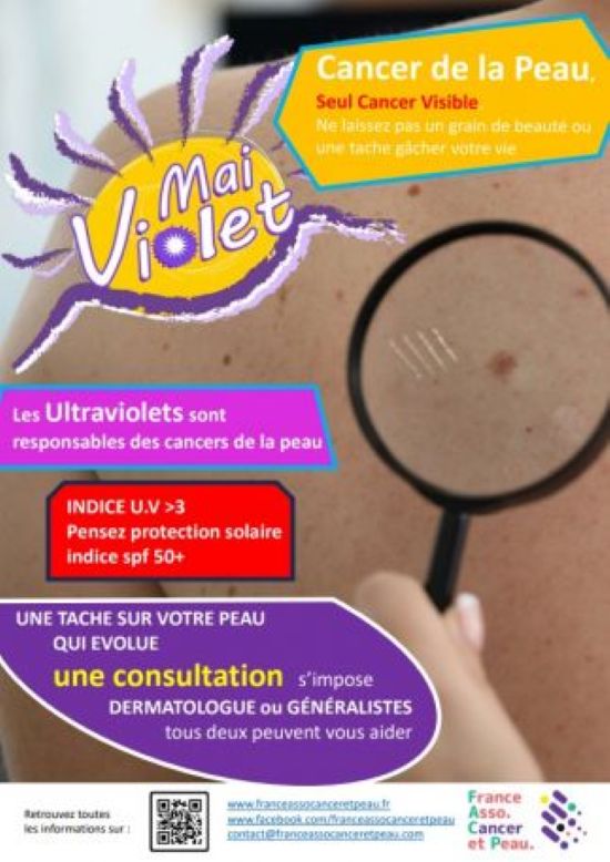 Cancer de la peau Mai violet